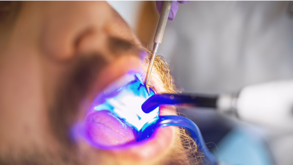 Everything You Should Know About Dental Fillings