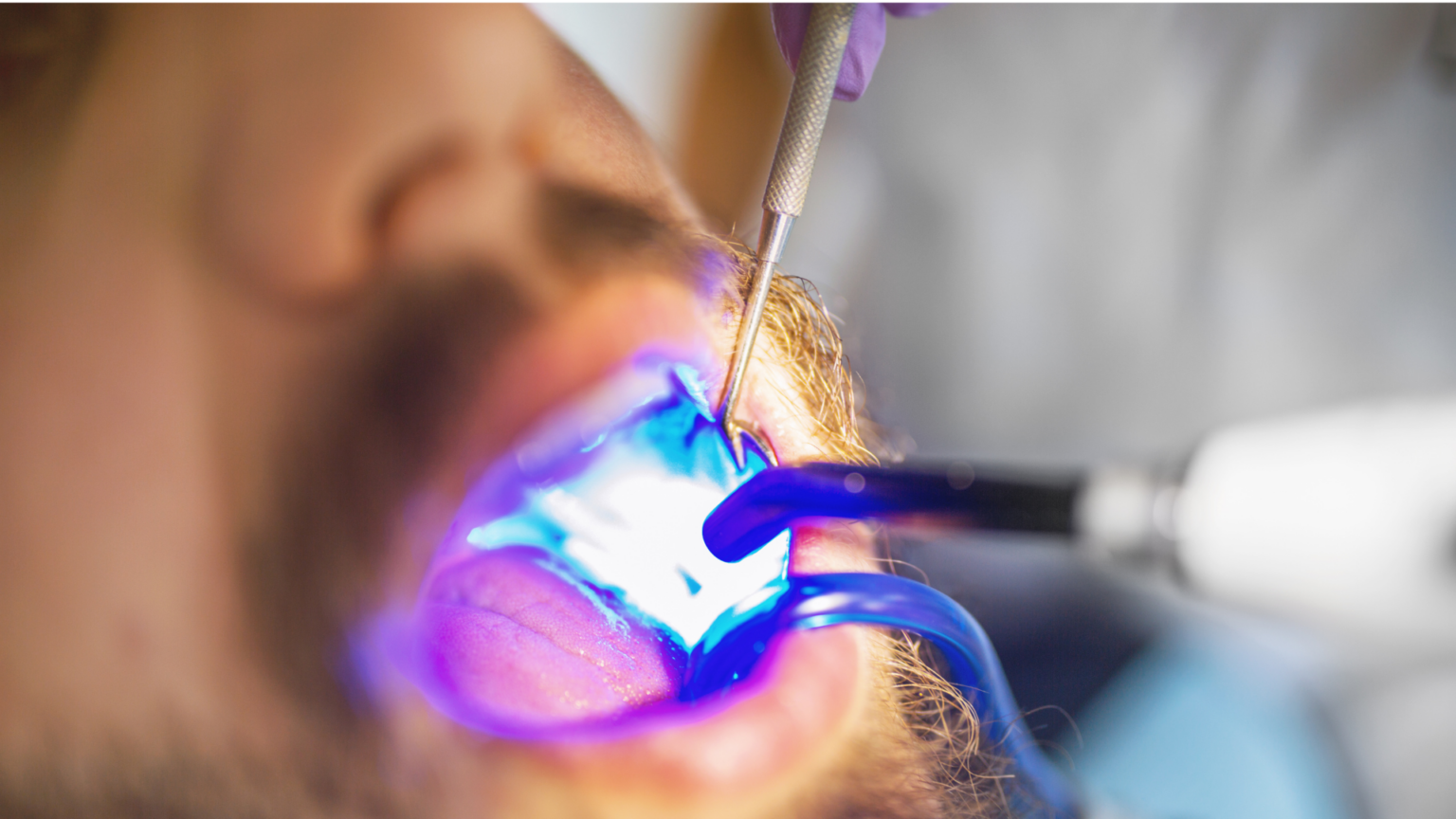 Everything You Should Know About Dental Fillings