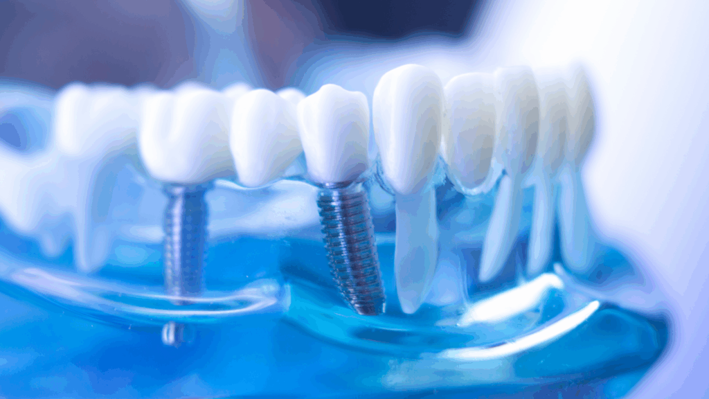 Can Gum Disease Keep You From Dental Implants? Here’s the Truth.